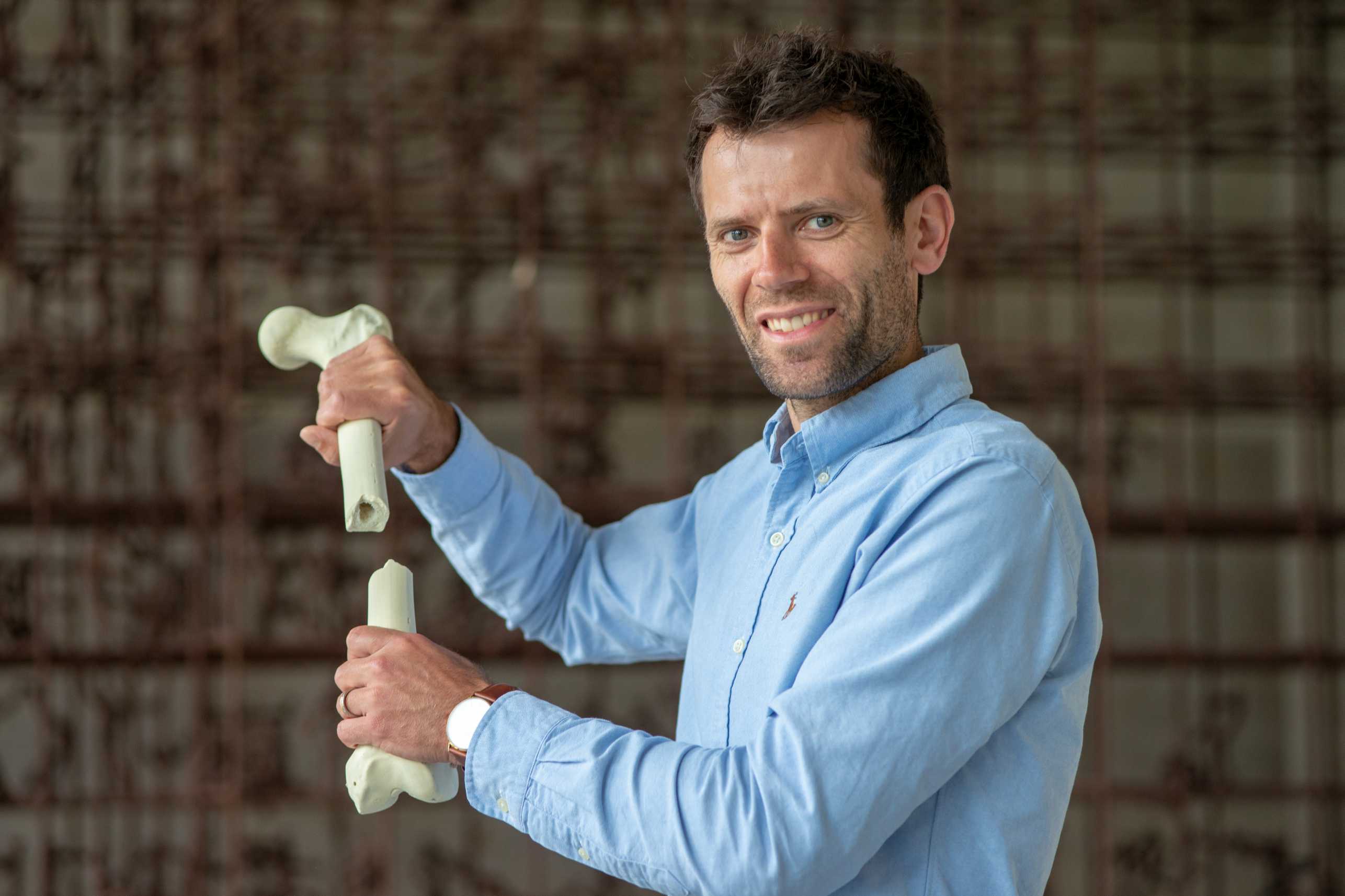 Thomas Zumbrunn holding a broken bone